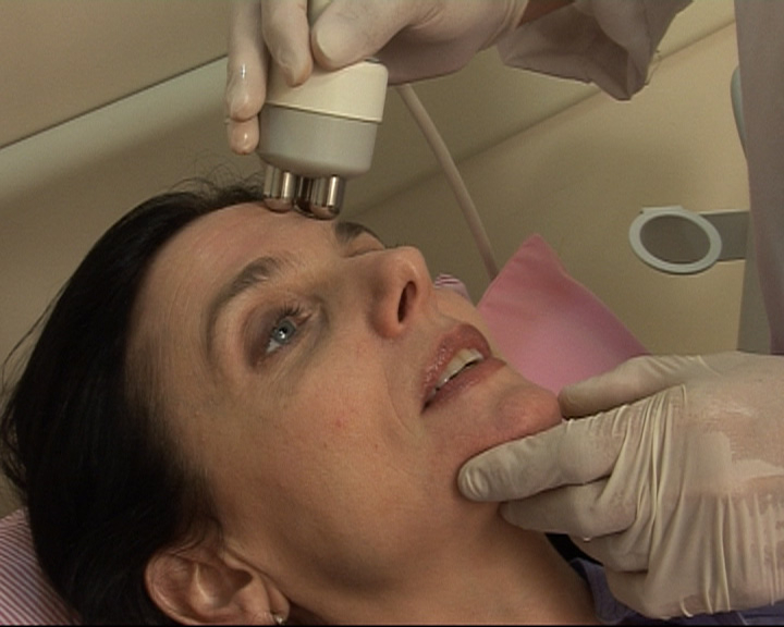Radiofrecuencia facial Radiofrecuencia facial